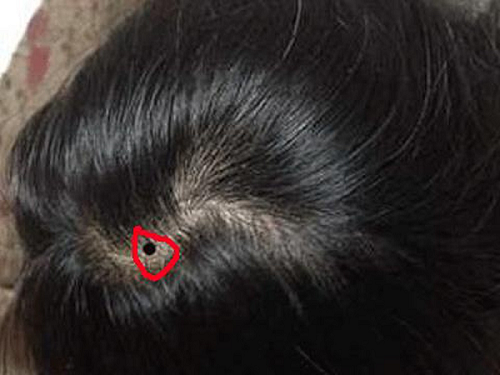 5 nốt ruồi đại phú quý, ai sở hữu thì càng có tuổi càng giàu sang - Hình 2 5 not ruoi dai phu quy, ai so huu thi cang co tuoi cang giau sang-Hinh-2