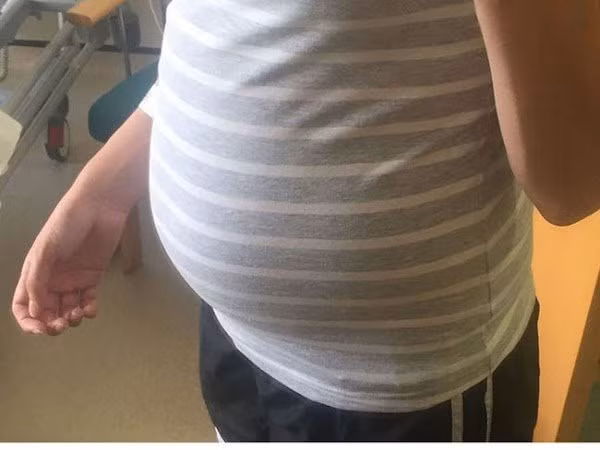 Tai sao co benh khi phat hien da giai doan cuoi?-Hinh-2