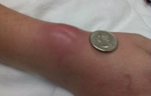 Vi sao chi em nen bo ngay thoi quen deo day buoc toc o co tay?-Hinh-5