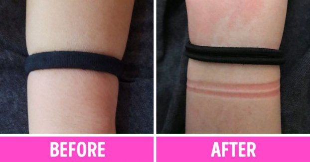 Vi sao chi em nen bo ngay thoi quen deo day buoc toc o co tay?-Hinh-2