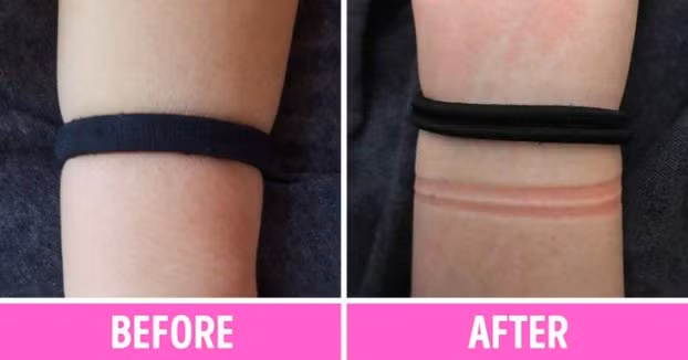 Vi sao chi em nen bo ngay thoi quen deo day buoc toc o co tay?-Hinh-3