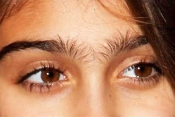 4 dang long may khong chiu sua, bao sao van xui deo bam mai