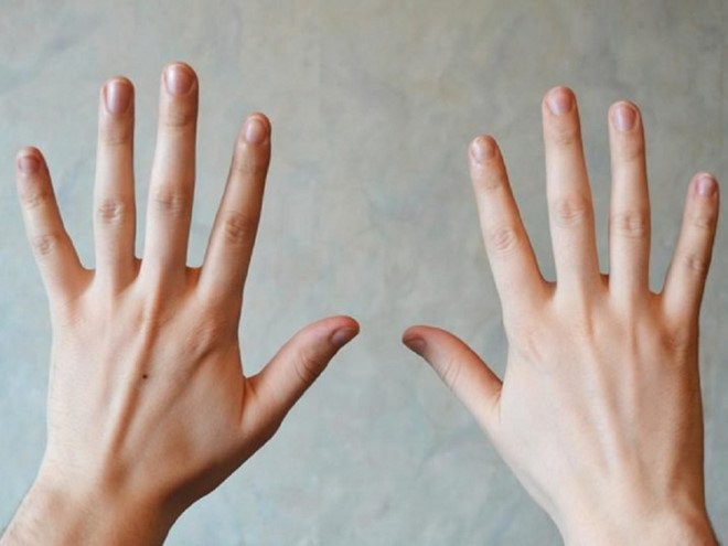 Co the xuat hien 5 dau hieu la chung to may man dang den gan