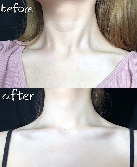 Thuc hien cac dong tac nay nep nhan vung co va cam nong se bay bien-Hinh-9