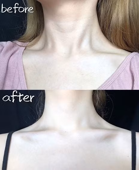 Thuc hien cac dong tac nay nep nhan vung co va cam nong se bay bien-Hinh-9