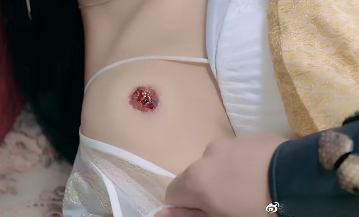 Theo Sohu, bộ phim Thanh Lạc do hai diễn viên Vương Tử Vy và Lưu Học Nghĩa đóng chính thu hút khán giả với đề tài xuyên không. Trong phim, Vương Tử Vy bị trúng mũi tên vào phần ngực. Tuy nhiên, khi cô được chữa trị, vị trí vết thương lại nằm ở trên vai.