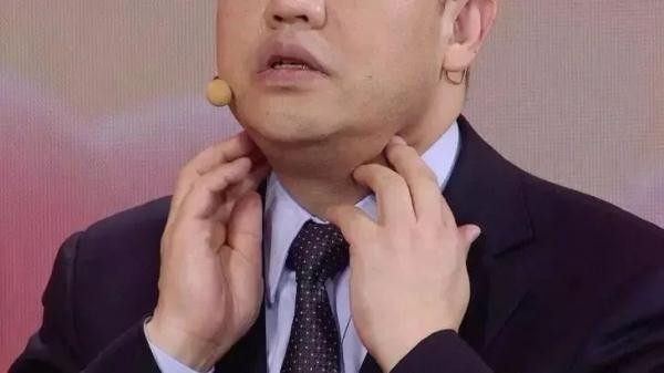 3 dấu hiệu của lưỡi cho thấy có thể bệnh tuyến giáp đang phát triển - Hình 4 3 dau hieu cua luoi cho thay co the benh tuyen giap dang phat trien-Hinh-4