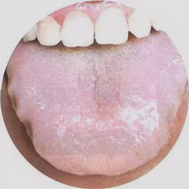 3 dau hieu cua luoi cho thay co the benh tuyen giap dang phat trien-Hinh-2