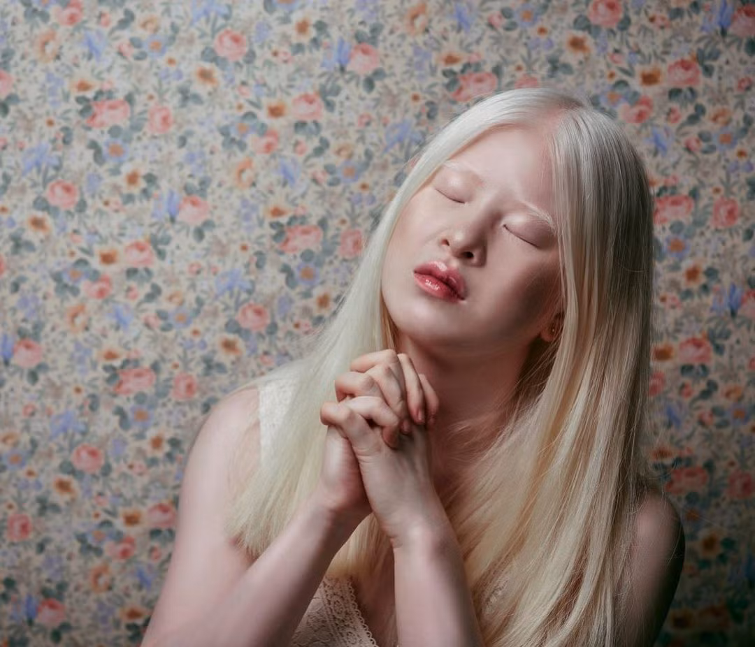 Vì làn da nhạy cảm và mắt yếu, không chịu được ánh sáng mạnh, Xueli gặp nhiều khó khăn để thích nghi với ống kính. Trong phần lớn ảnh, Xueli nhắm hoặc hé mắt, chỉ mở khi không có đèn flash song điều này cũng được cho trở thành điểm thu hút riêng ở cô. "Quản lý của tôi thường nói trước về điều này cho các nhãn hàng để họ cân nhắc".