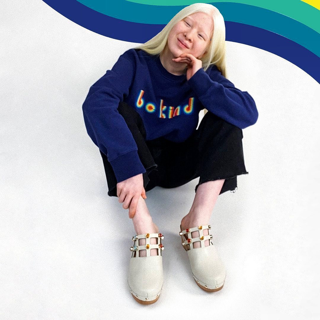 Xueli bén duyên với nghề người mẫu vào năm 11 tuổi. Một nhà thiết kế ở Hong Kong (Trung Quốc) ra mắt bộ sưu tập thời trang để giúp cậu con trai bị sứt môi trở nên tự tin hơn và tôn vinh vẻ đẹp của sự "không hoàn hảo". Khi được mẹ nuôi Xueli liên hệ, nhà thiết kế ngỏ ý mời cô bé bạch tạng làm người mẫu trình diễn trong bộ sưu tập. "Đó là một trải nghiệm tuyệt vời", Xueli nói với BBC.