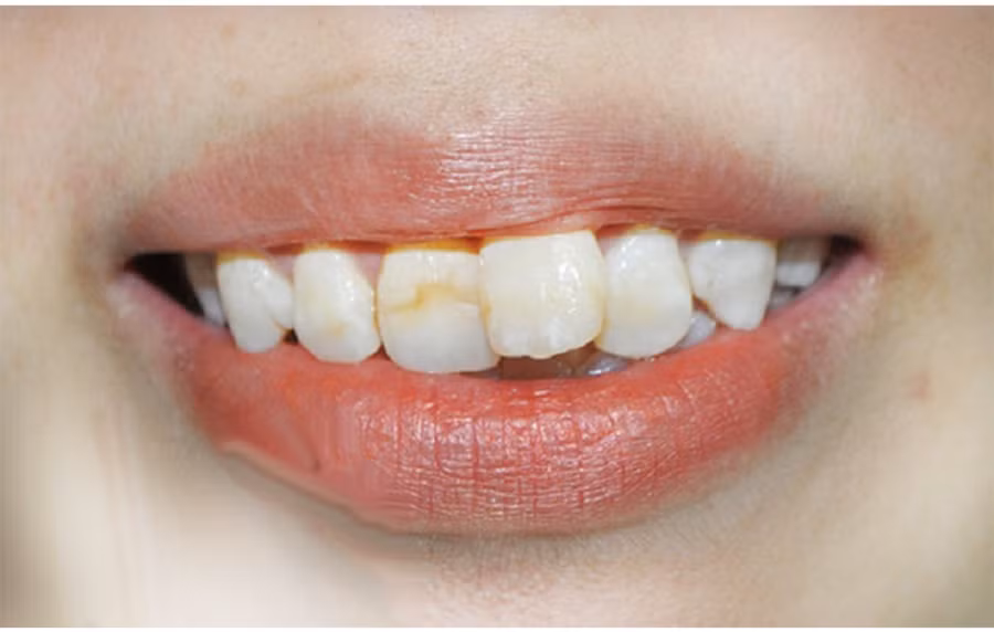 Nhin tuong rang phu nu biet so giau sang hay ngheo hen-Hinh-2