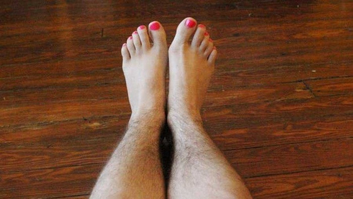 Ram long o phu nu co the do lam dung hormone