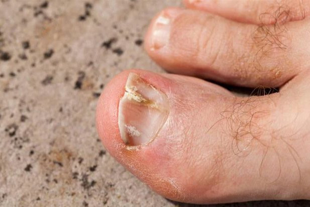 5 dau hieu tren ban chan canh bao nguoi tuoi tho ngan