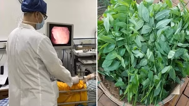 6 loai rau la khac tinh cua benh dau da day