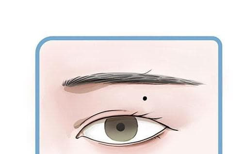 Nhin not ruoi quanh mat vai giay, biet ngay tuong lai suong kho