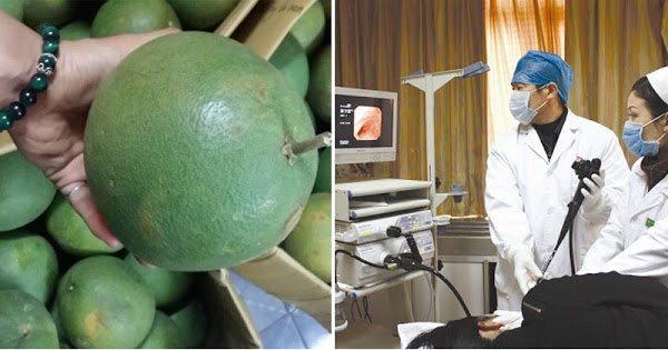 4 loại quả là kẻ thù hại dạ dày đáng sợ nhất 4 loai qua la ke thu hai da day dang so nhat