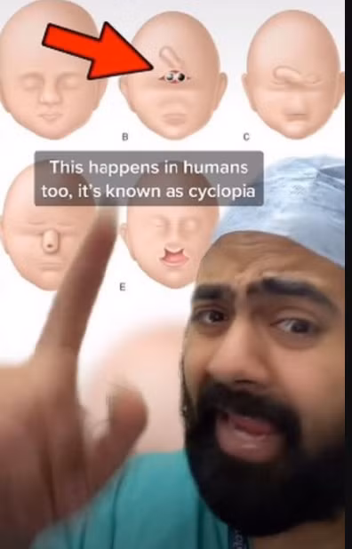 Sinh vật chỉ có một mắt to khổng lồ kỳ lạ gây xôn xao