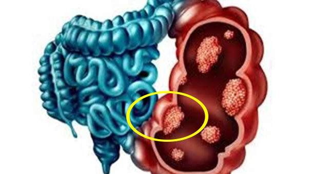 Nguoi co 3 bo phan nay cang sach thi cang song tho