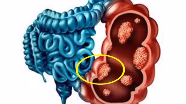 Nguoi co 3 bo phan nay cang sach thi cang song tho