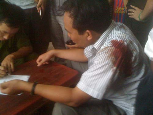 Người điều khiển xe máy bị bắn vào vai trái.