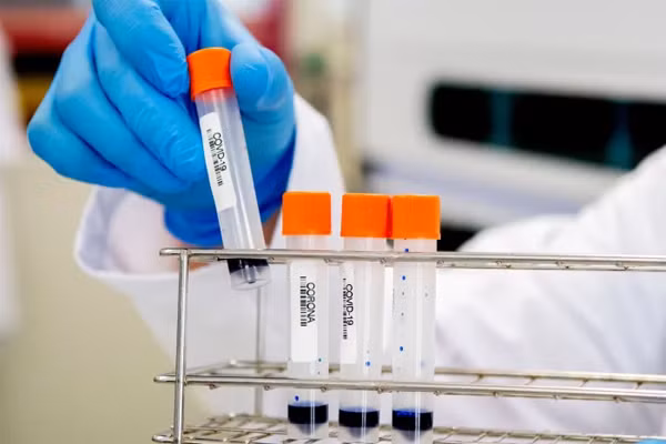 Ty le tu vong do bien chung Omicron so voi cac dot dich truoc