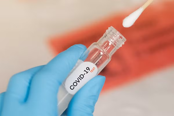 So ca tai nhiem COVID-19 cao khong tuong vi bien the Omicron