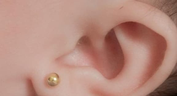 Thuong xuyen ngua o lo tai, coi chung dau hieu cua 4 loai benh-Hinh-2