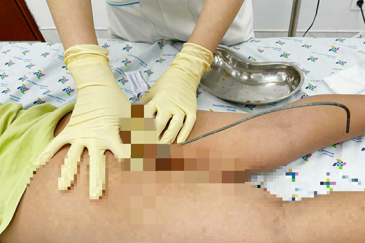 Be trai 6 tuoi nhet que sat vao hau mon vi bat chuoc phim