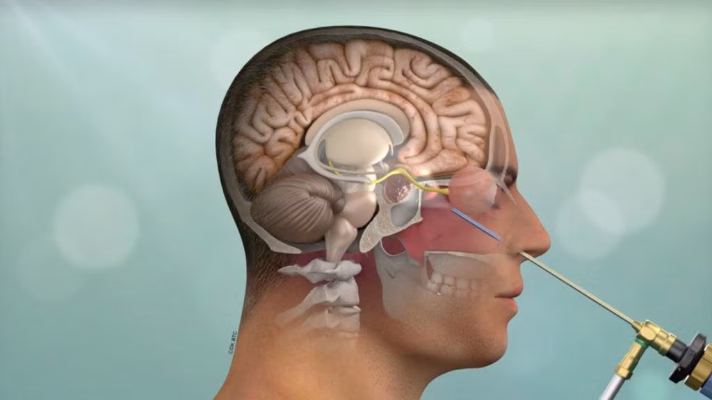 Ghep toan bo nao nguoi co kha thi, bat tu?-Hinh-4