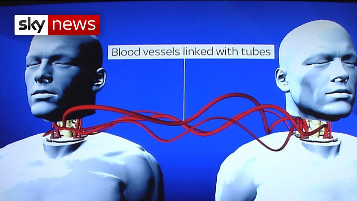 Ghep toan bo nao nguoi co kha thi, bat tu?-Hinh-7