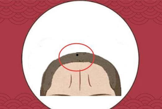 Co 5 not ruoi den tren co the, cang ve gia cang giau co-Hinh-4