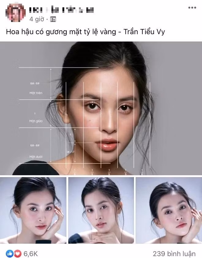 Hoa hau Tieu Vy thoi den nhem, rang khap khenh khong nhan ra-Hinh-9