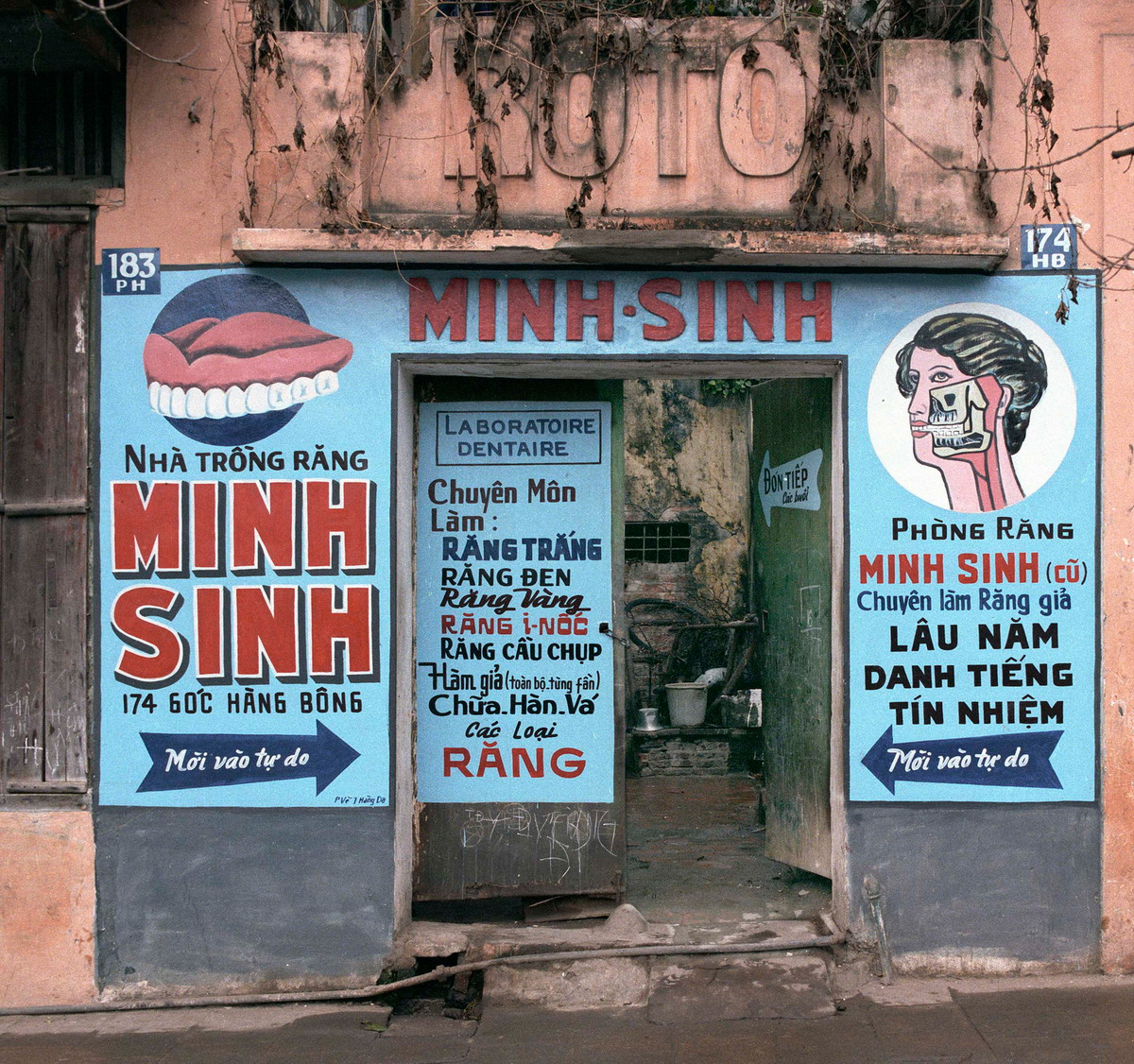 Bảng hiệu vẽ bằng tay trên tường của phòng khám răng 174 Hàng Bông, năm 1986. Ảnh: William E Crawford.