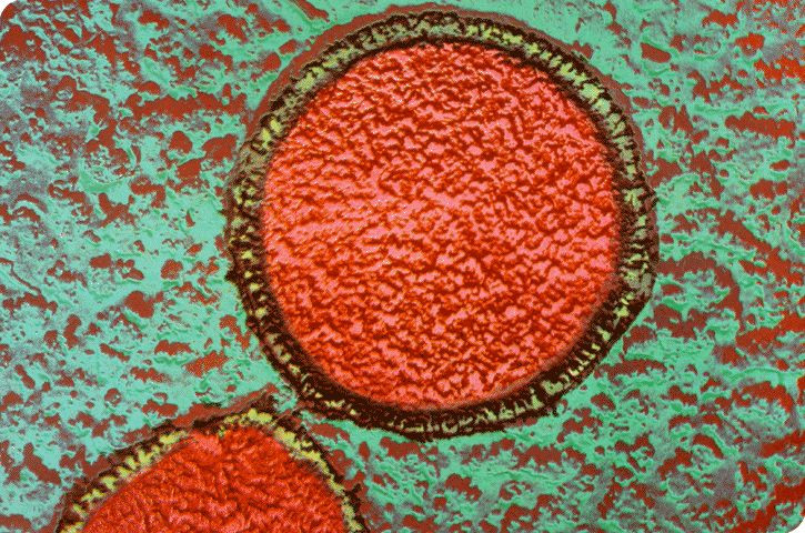  2. Có thể sống trong môi trường khắc nghiệt nhất trên Trái Đất. Một trong những đặc điểm nổi bật của cổ khuẩn là khả năng sinh tồn trong các môi trường cực kỳ khắc nghiệt như siêu mặn, nhiệt độ cực cao, axit cực mạnh... Ảnh: Pinterest.