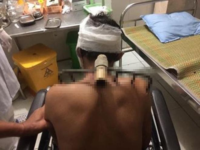 Vi sao con trai bo bo cao vao vai bo trong bua com?