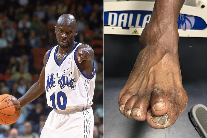 Huyền thoại Dirk Nowitzki chia sẻ hình ảnh những ngón chân của người đồng đội cũ Darrell Armstrong lên mạng xã hội vào năm 2017. "Darrell Armstrong gọi tôi là một xác ướp khổng lồ, nhưng anh ta lại có bàn chân khủng long", Nowitzki nói một cách dí dỏm.