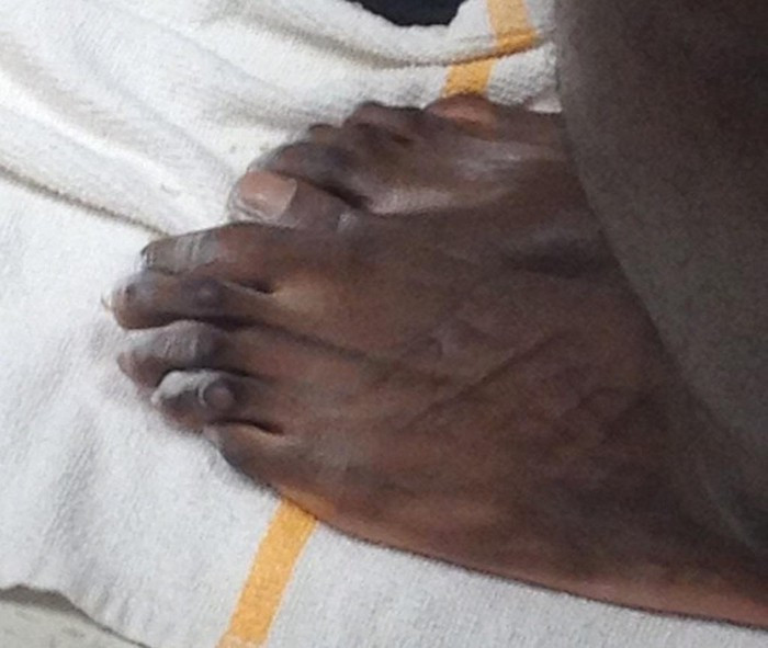 Evan Turner từng chia sẻ hình ảnh đôi bàn chân của một đồng đội ở Philadelphia 76ers lên mạng xã hội vào năm 2012. "Các bạn nghĩ chúng thuộc về ai? Jason Richardson, Royal Ivey, Jrue Holiday, Kwame Brown hay Spencer Hawes?", Turner thách đố người hâm mộ. Người hâm mộ vẫn chưa thể biết chính xác đó là những ngón chân của ai cho đến ngày hôm nay. Thậm chí, Turner cũng chưa bao giờ đưa ra đáp án.