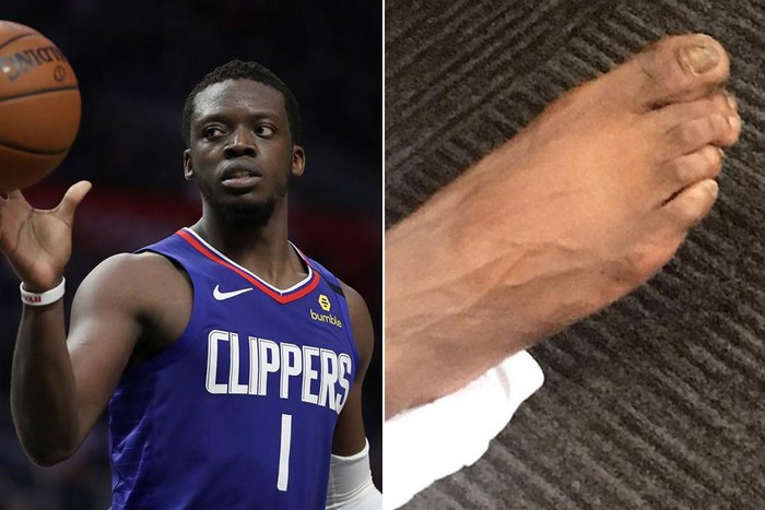 Trang tin tức TMZ từng đăng tải hình ảnh những ngón chân xiêu vẹo của Reggie Jackson vào năm 2017. "Chân của một người đàn ông chăm chỉ", đồng đội cũ của Jackson, Andre Drummond nhận xét.