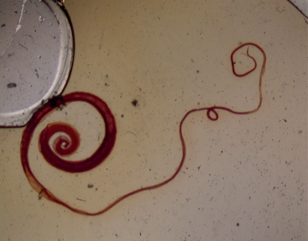 Giun tóc (Trichuris trichiura) dài 3-5 cm, ký sinh ở người. Loài này sống chủ yếu ở vùng nhiệt đới, lây nhiễm vào những người ăn phải thức ăn bị nhiễm phân có trứng giun. Vòng đời của chúng kết thúc trong ruột.