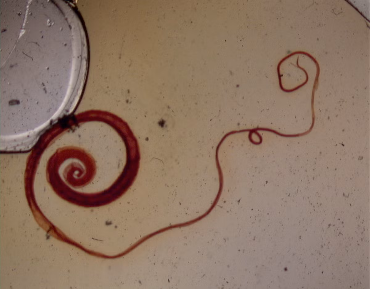 Giun tóc (Trichuris trichiura) dài 3-5 cm, ký sinh ở người. Loài này sống chủ yếu ở vùng nhiệt đới, lây nhiễm vào những người ăn phải thức ăn bị nhiễm phân có trứng giun. Vòng đời của chúng kết thúc trong ruột.