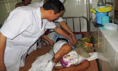 Cháu Thành khi đang điều trị tại Bệnh viện Đa khoa Hà Tĩnh.