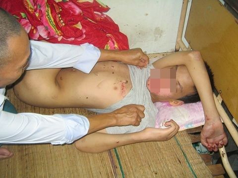 Cháu Tú khi ở trong bệnh viện.