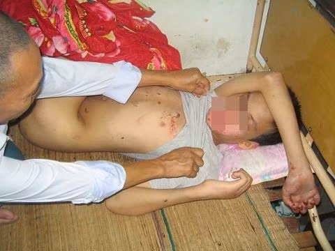 Cháu Tú khi ở trong bệnh viện.