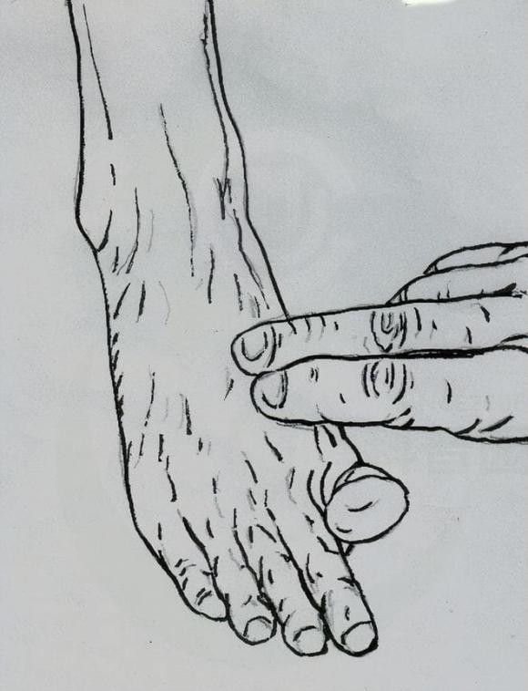 Tu kiem tra xem mach mau co bi tac hay khong-Hinh-2