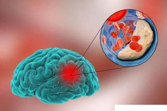Tu kiem tra xem mach mau co bi tac hay khong-Hinh-3