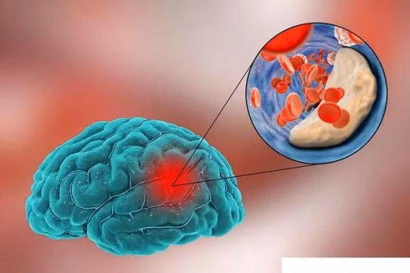 Tu kiem tra xem mach mau co bi tac hay khong-Hinh-3