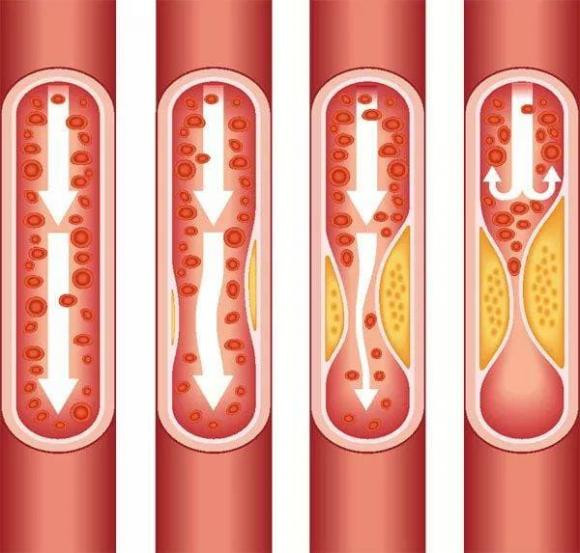 Tu kiem tra xem mach mau co bi tac hay khong