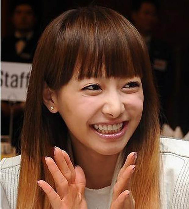 Victoria f(x) có hàm răng đều tăm tắp nhưng khi cười là bọng mắt, nếp nhăn, da lão hóa điểm danh một lượt.