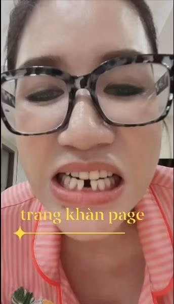 Cựu người mẫu show cận hàm răng hài hước.