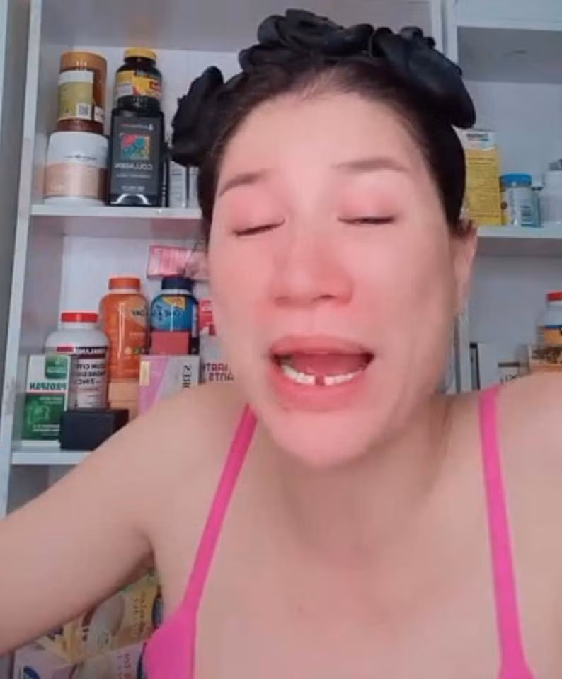 br/> Mới đây, Trang Trần gây chú ý khi livestream bán hàng với hàm răng gãy mất một chiếc. Một pha tấu hài cực mạnh đến từ vị trí của Trang Khàn. Chắc hẳn nhiều người sẽ nghĩ rằng sẽ có một vụ ẩu đả, đánh lộn hay vấp ngã ở đây nhưng lý do thực chất khiến dân tình ngã ngửa.